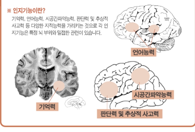 인지기능장애